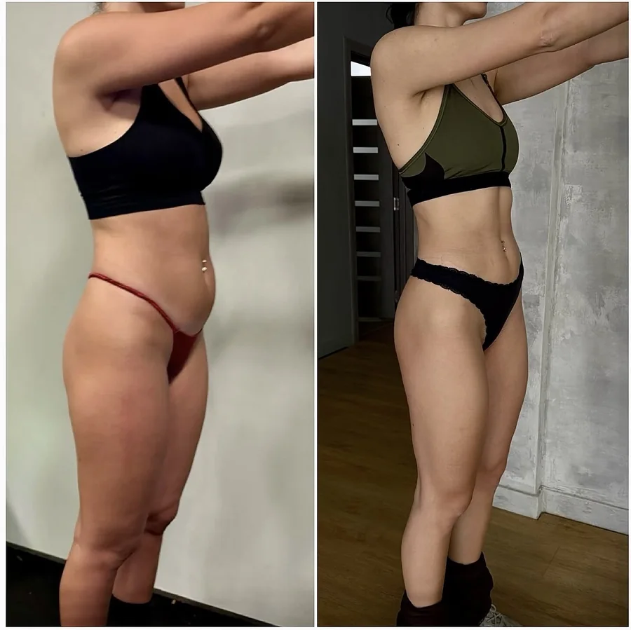 Daiana — −8 kg in 8 months