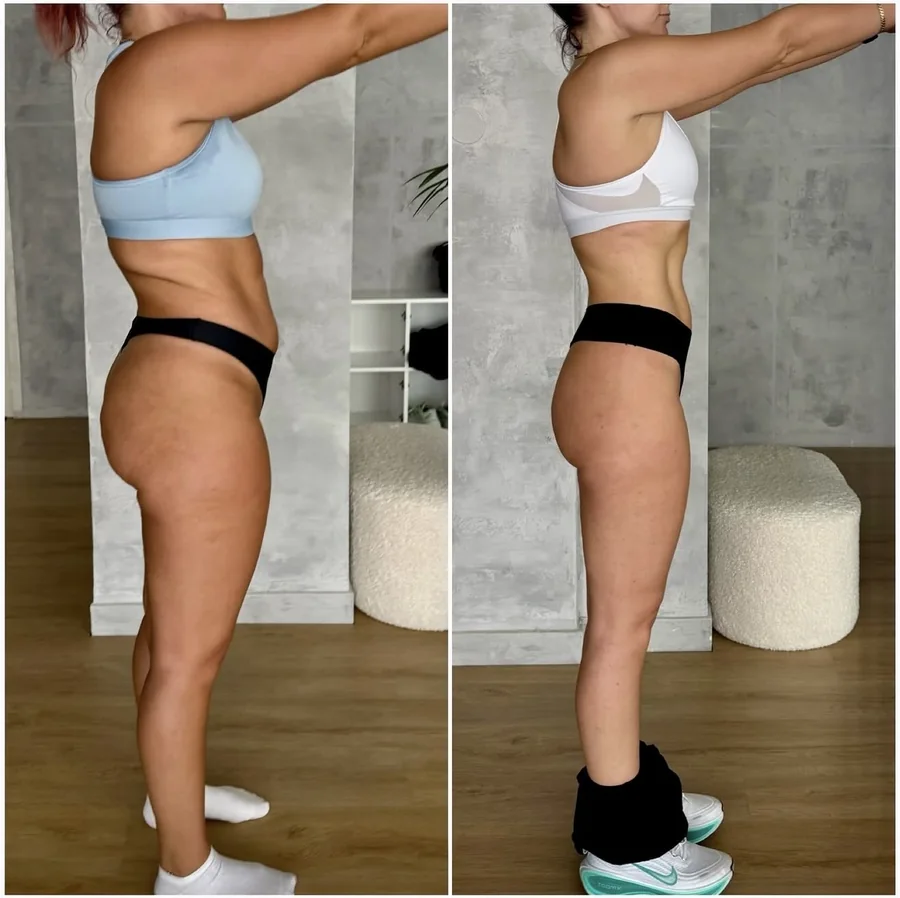 Ioana — −14 kg in 12 months