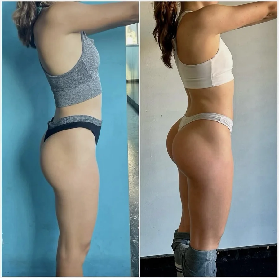 Gabriela — +5 kg in 14 months