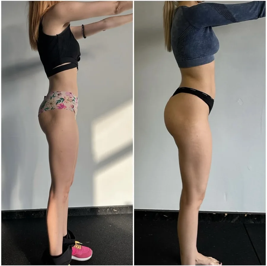 Diana — +6 kg in 12 months