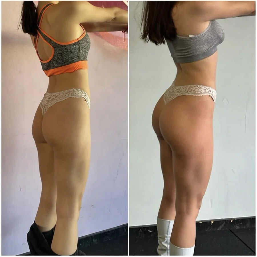 Lia — +5 kg in 8 months